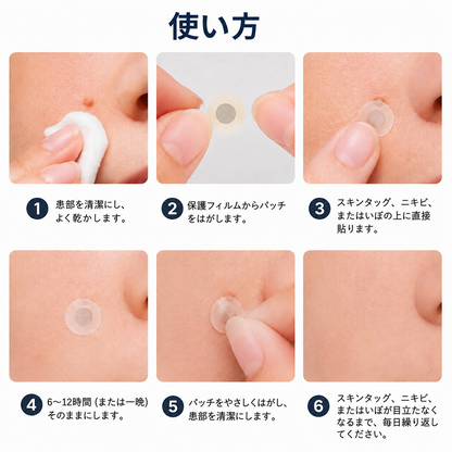 🔥Curalona® 2-in-1 マイクロニードル＆ハイドロコロイドパッチ🔥 | 隆起したほくろ、ニキビ、扁平イボ、皮膚線維腫を除去 | シワ、傷跡、肌の気になる部分の改善をサポート | 顔や体に使える目立たないパッチ